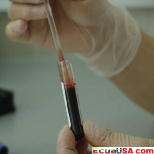 Un Salvavidas en el Norte: Hospital de Enseñanza Calderón Refuerza Servicios de Atención al VIH