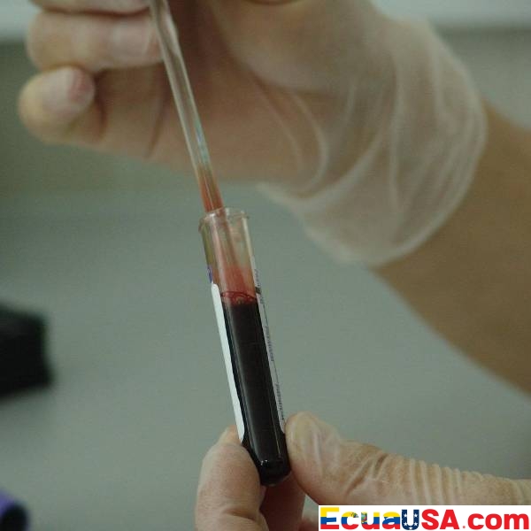 Un Salvavidas en el Norte: Hospital de Enseñanza Calderón Refuerza Servicios de Atención al VIH