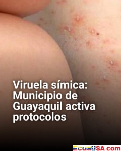 Alerta sanitaria en Guayaquil: activan protocolos por caso de viruela símica en Ecuador